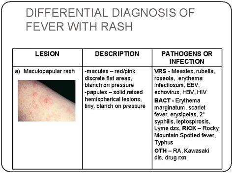 fever and non-blanching rash